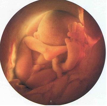 ABORCJA - CIASNO-ALE POCZEKAM.jpg