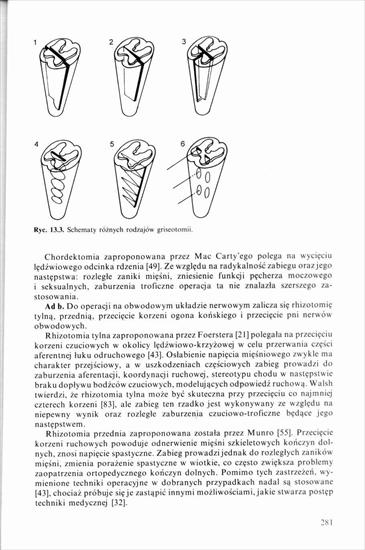 Schorzenia i urazy kręgosłupa, Kiwerski 1997 - 0000278.jpg